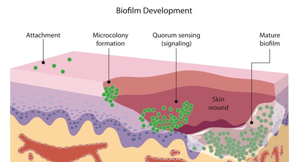 Biofilm development
