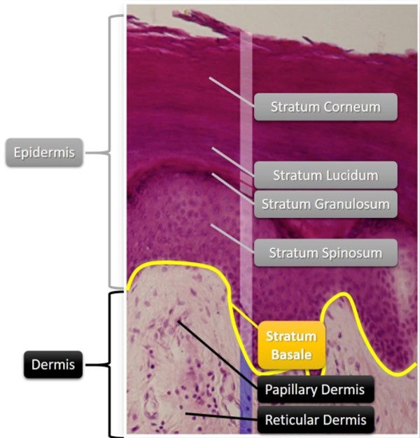 Epidermis and dermis (histologic image)