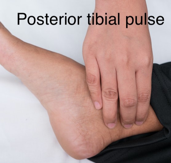 Posterior tibial pulse