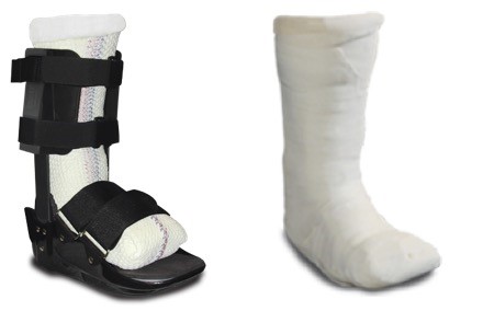 Total contact casts (TCCs). Left: one-piece, roll-on TCC; right: traditional TCC