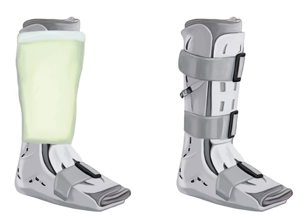 Left: irremovable cast walker. Right: removable walker. 