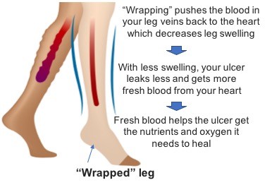 3. Vein and blood flow with and without compression