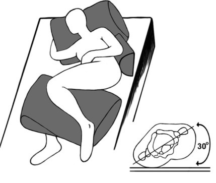1. 30° lateral tilt position