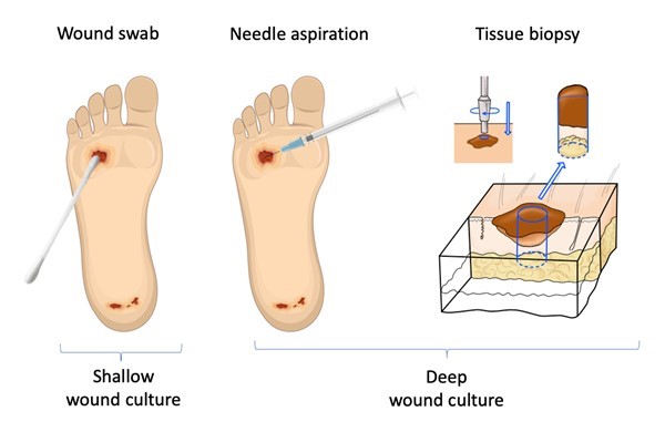 Wound sampling techniques for wound culture