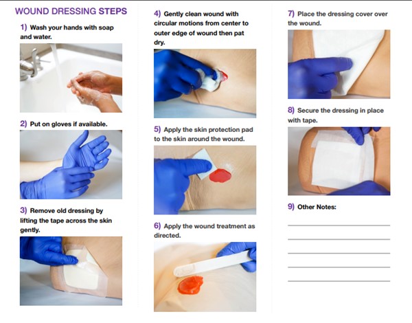 Custom wound dressing change brochure