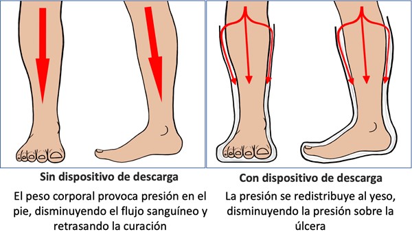 Dispositivo de descarga