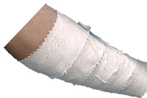 Application of paste bandage, spiral fashion