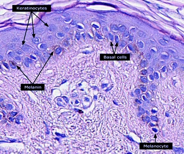 Keratinocytes, basal cells. Setijanti H.B. et al CC BY 4.0