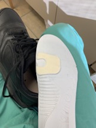 Metatarsal pad (felt)