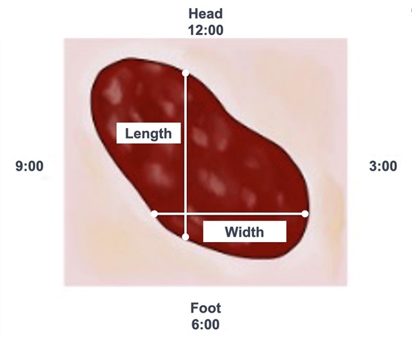 Measuring length and width