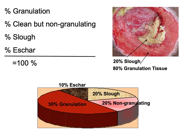 Estimation of wound bed tissue type proportion